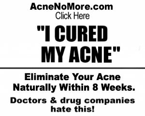 Join Acne No More
