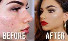 How To Cover Acne With Makeup Without Looking Cakey