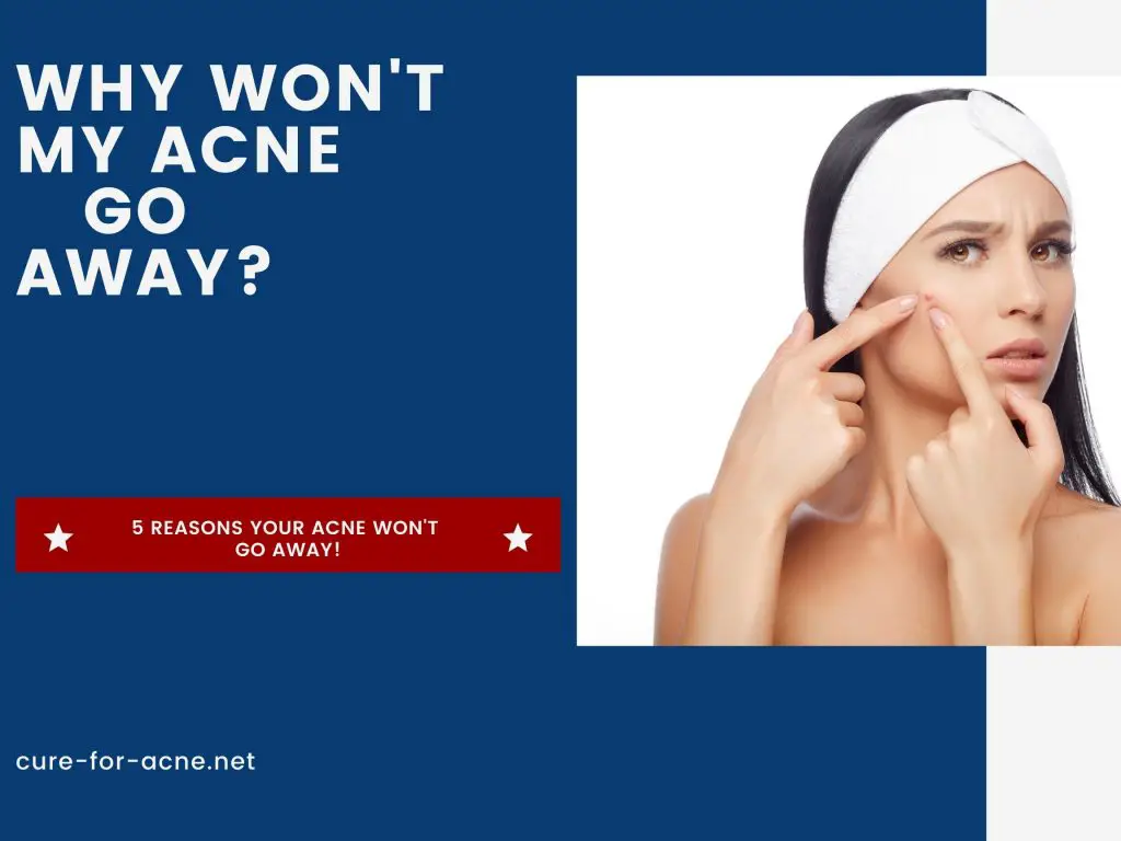 Why Won't My Acne Go Away? - Cure For Acne