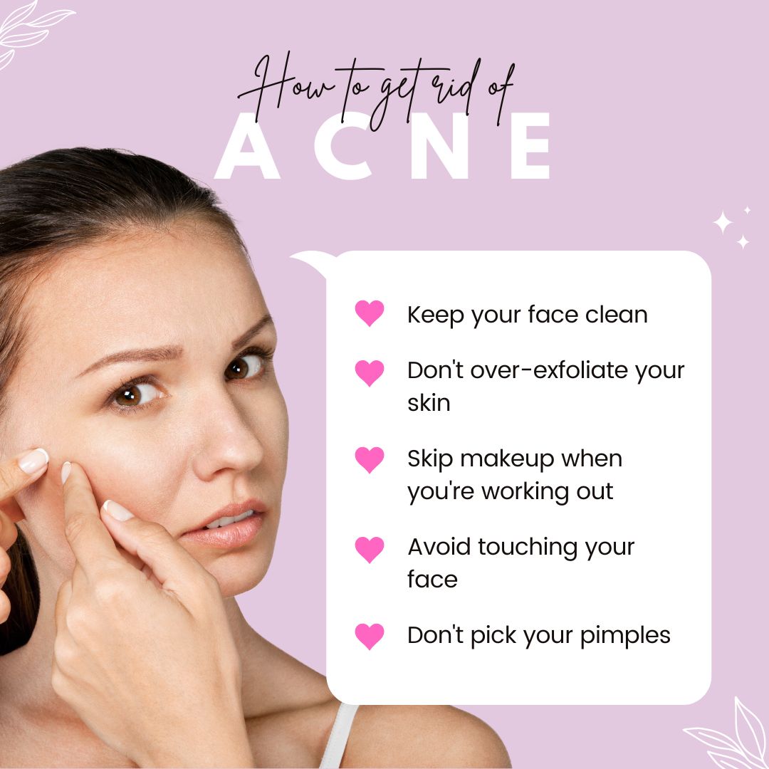 How To Get Rid Of Acne Scars